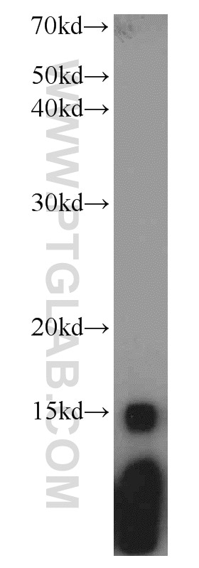 Western Blot (WB) analysis of Jurkat cells using HIST2H2AA4 Polyclonal antibody (15302-1-AP)