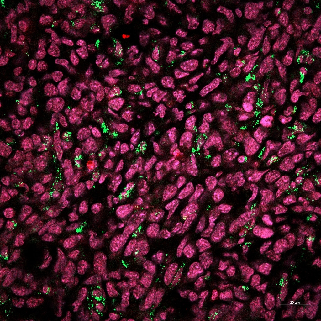Immunofluorescence (IF) / fluorescent staining using Histone H2B Polyclonal antibody (15857-1-AP)