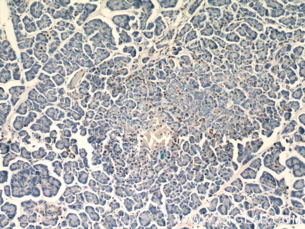 Immunohistochemistry (IHC) staining of human pancreas tissue using Histone H2B Polyclonal antibody (15857-1-AP)