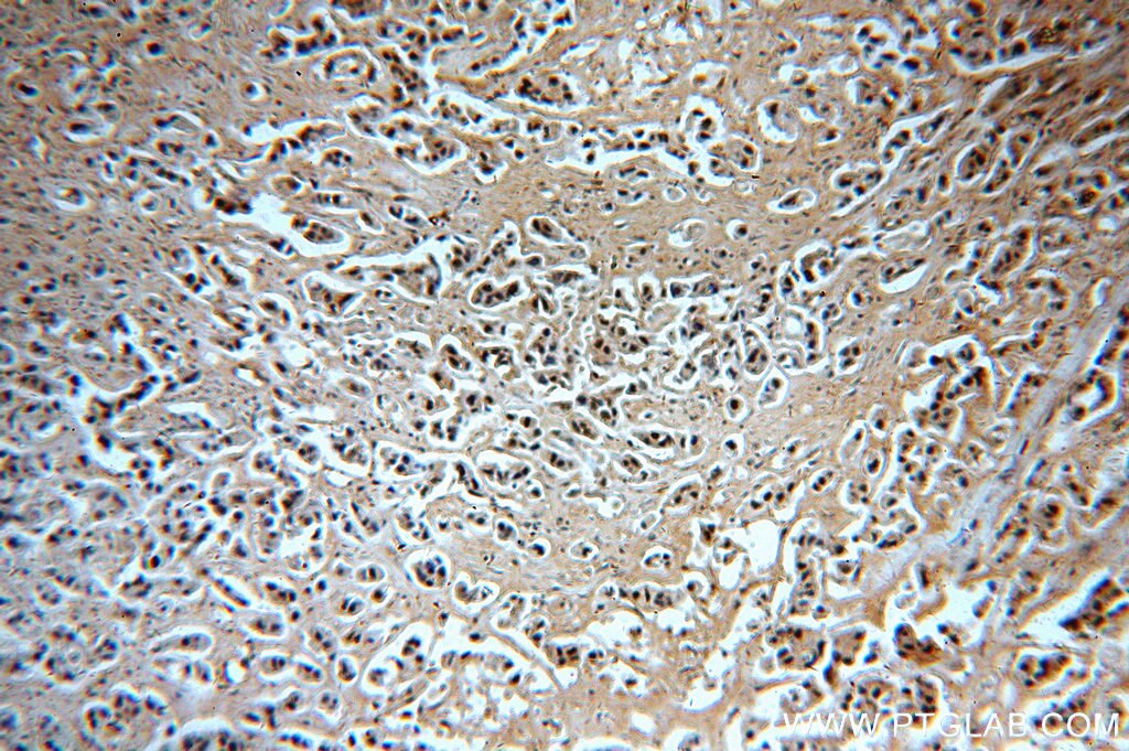 Histone H2B