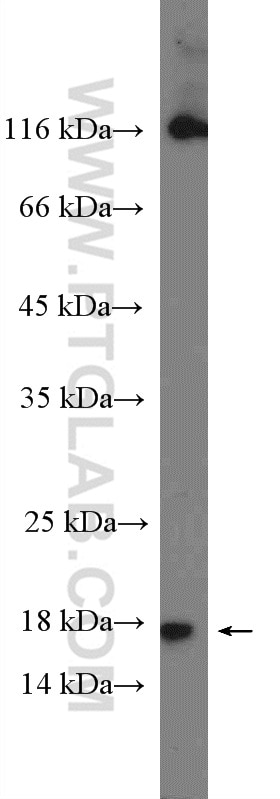 WB analysis of rat kidney using 15857-1-AP