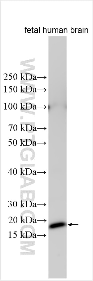Western Blot (WB) analysis of fetal human brain tissue using Histone H2A type 3 Polyclonal antibody (10445-1-AP)