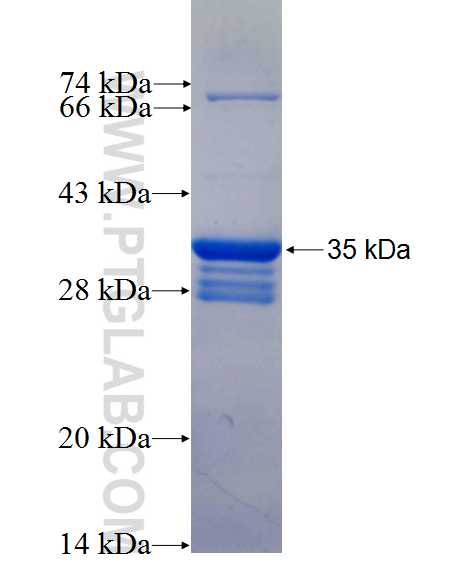 HIST3H2A fusion protein Ag0374 SDS-PAGE