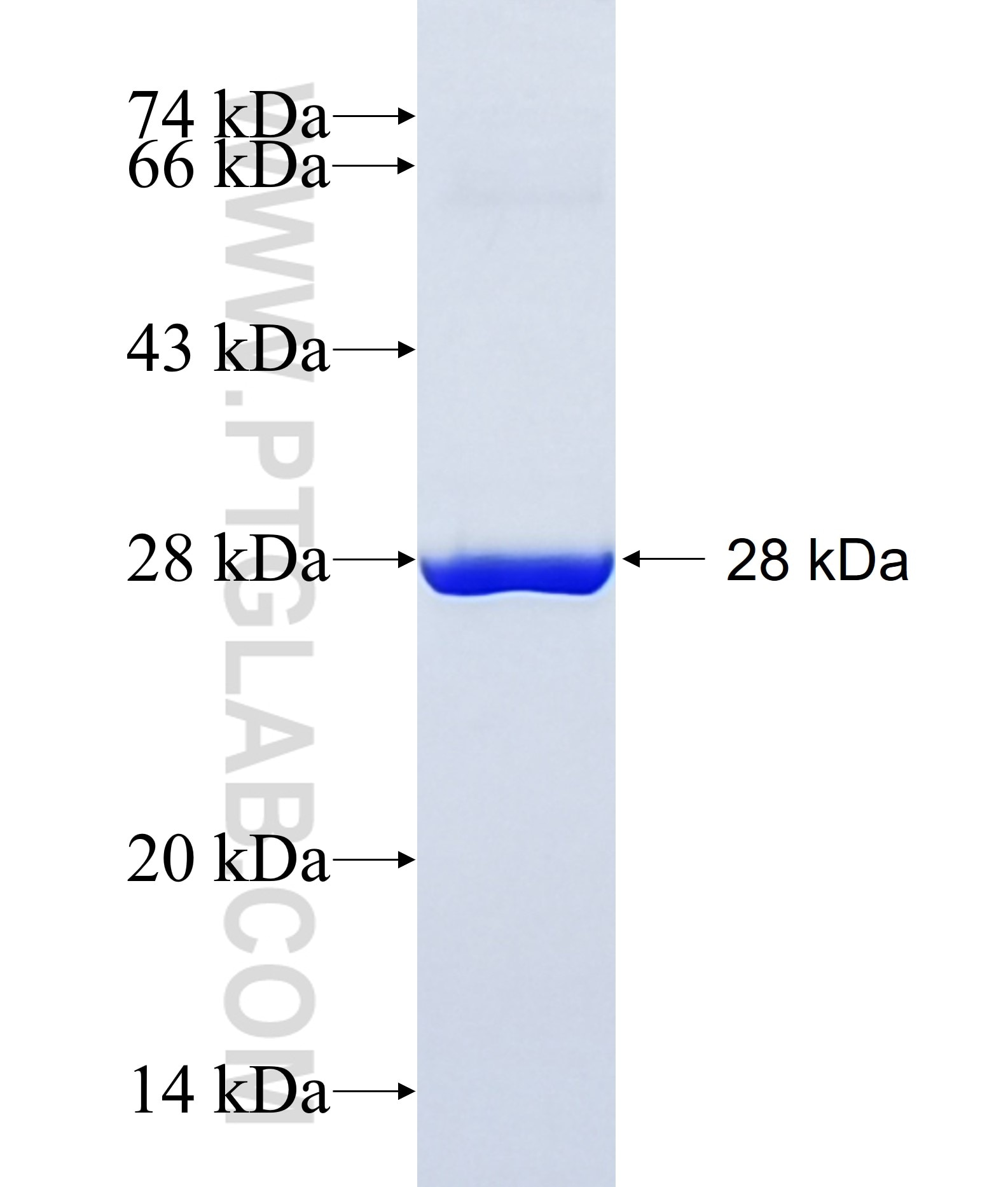 HIV-1-P24 fusion protein Ag32906 SDS-PAGE HIV-1-P24 fusion protein Ag32906 SDS-PAGE