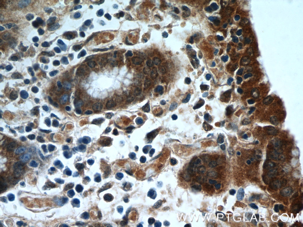 Immunohistochemistry (IHC) staining of human stomach tissue using HIVEP1 Polyclonal antibody (25168-1-AP)