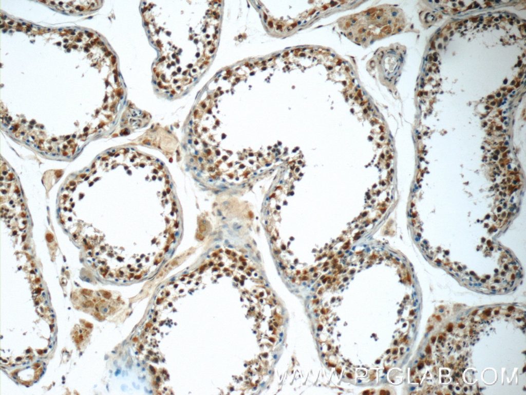 Immunohistochemistry (IHC) staining of human testis tissue using HIVEP1 Polyclonal antibody (25168-1-AP)