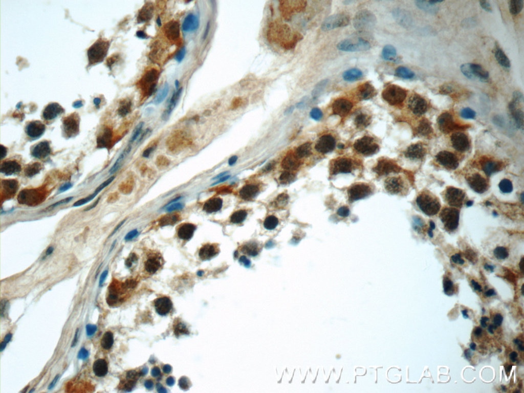 Immunohistochemistry (IHC) staining of human testis tissue using HIVEP1 Polyclonal antibody (25168-1-AP)