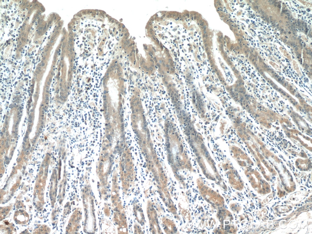 Immunohistochemistry (IHC) staining of human stomach tissue using HIVEP1 Polyclonal antibody (25168-1-AP)