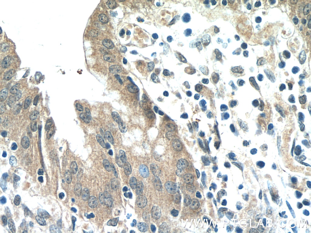 Immunohistochemistry (IHC) staining of human stomach tissue using HIVEP1 Polyclonal antibody (25168-1-AP)