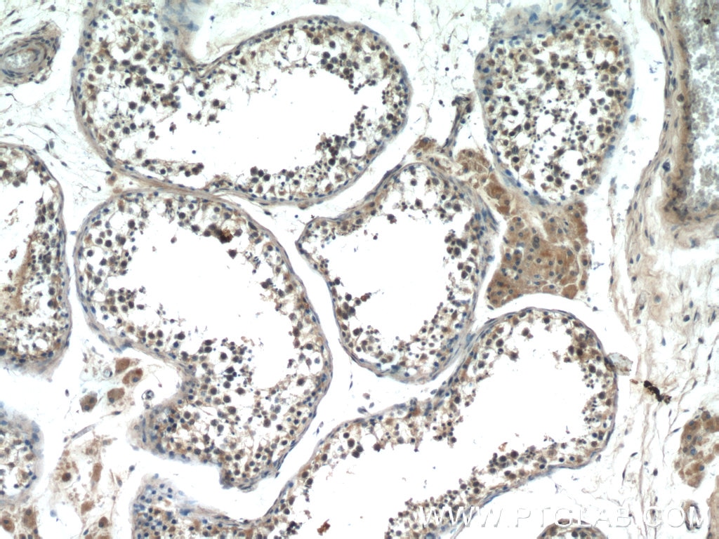 Immunohistochemistry (IHC) staining of human testis tissue using HIVEP1 Polyclonal antibody (25168-1-AP)