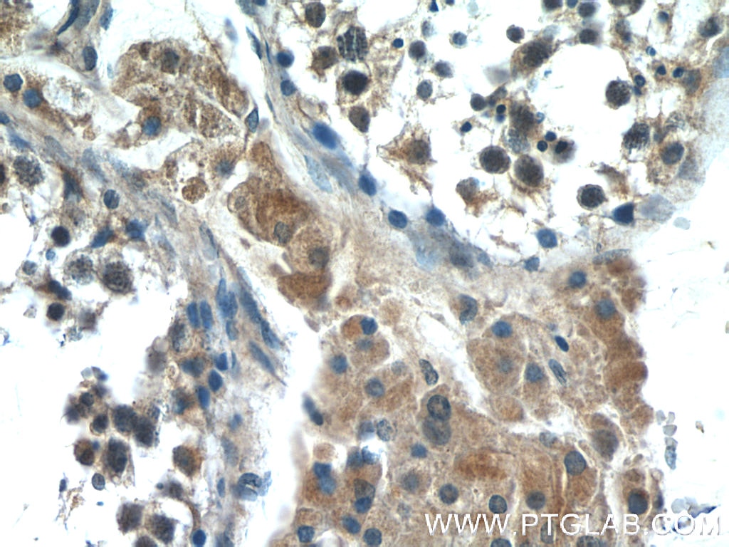 Immunohistochemistry (IHC) staining of human testis tissue using HIVEP1 Polyclonal antibody (25168-1-AP)