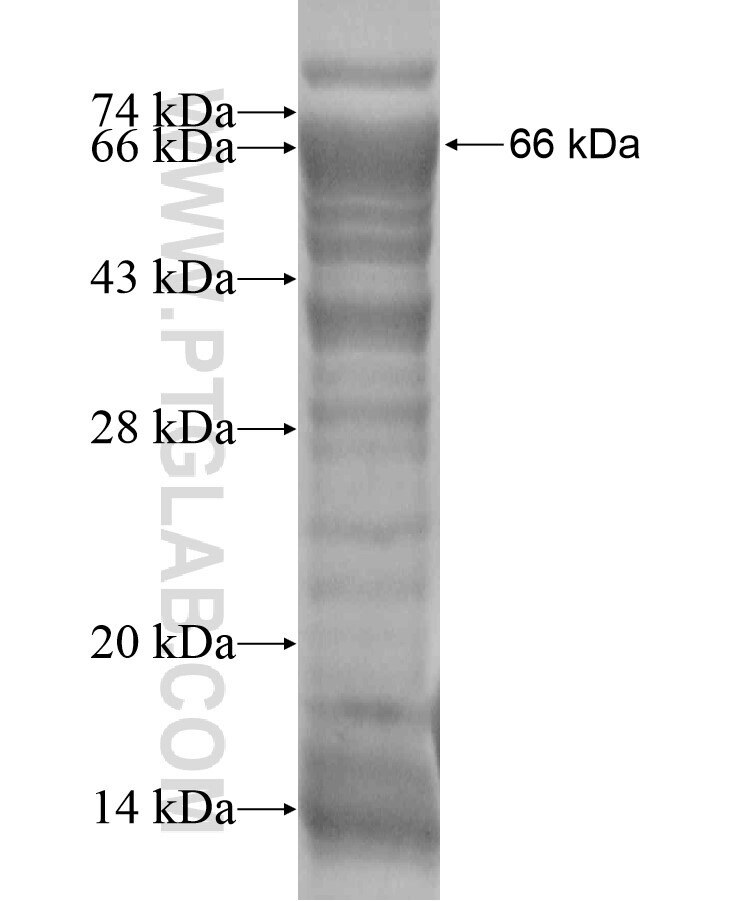 HIVEP1 fusion protein Ag18462 SDS-PAGE