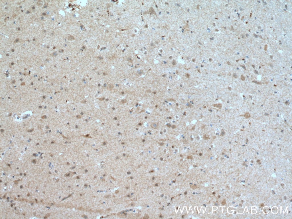 Immunohistochemistry (IHC) staining of human brain tissue using HJURP Polyclonal antibody (15283-1-AP)