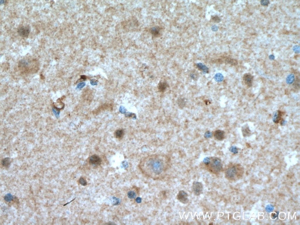 Immunohistochemistry (IHC) staining of human brain tissue using HJURP Polyclonal antibody (15283-1-AP)