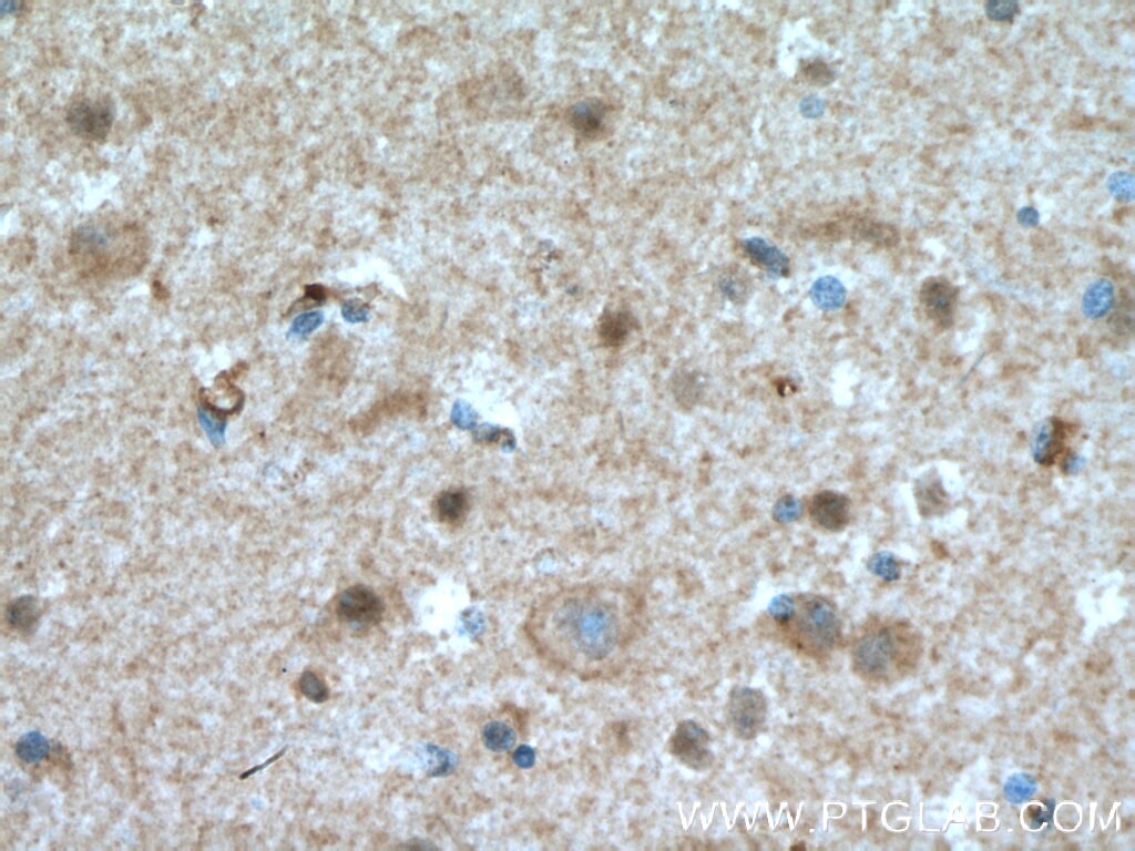 IHC staining of human brain using 15283-1-AP