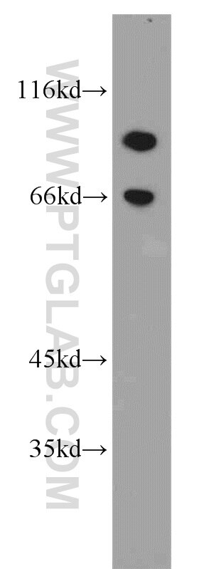 HJURP Polyclonal antibody