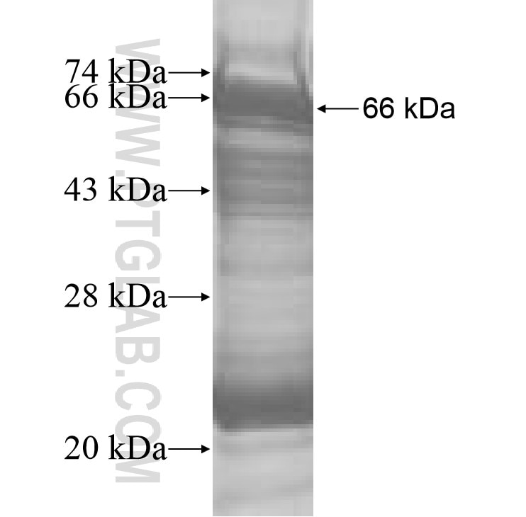HJURP fusion protein Ag7402 SDS-PAGE
