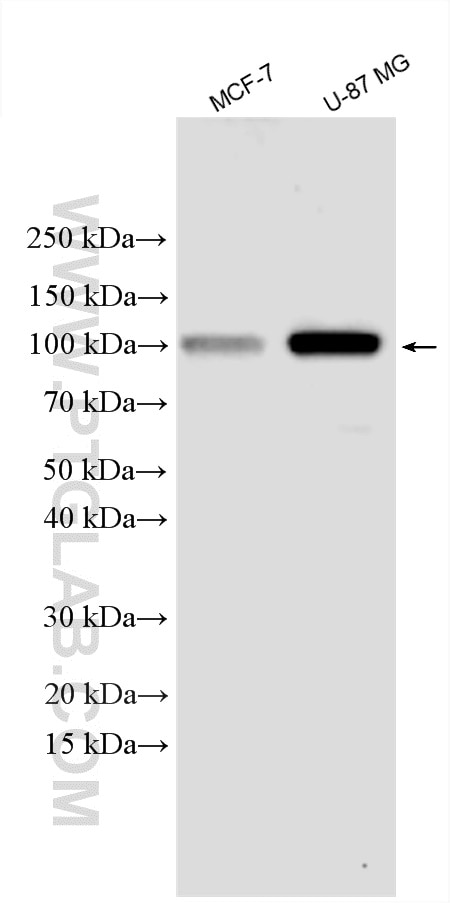 Western Blot (WB) analysis of various lysates using Hexokinase 1 Polyclonal antibody (15656-1-AP)