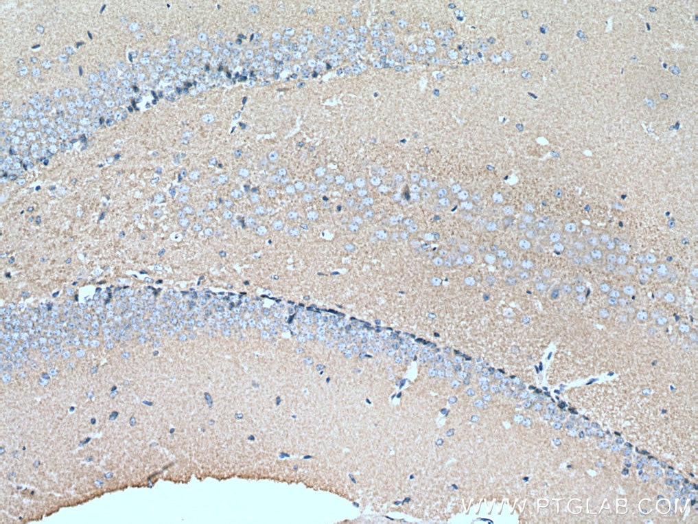 Immunohistochemistry (IHC) staining of mouse brain tissue using human Hexokinase 1 Polyclonal antibody (19662-1-AP)