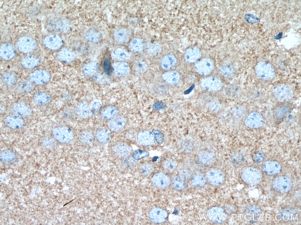IHC staining of mouse brain using 19662-1-AP