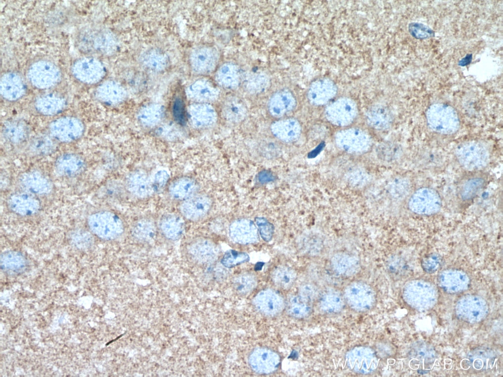 Immunohistochemistry (IHC) staining of mouse brain tissue using human Hexokinase 1 Polyclonal antibody (19662-1-AP)