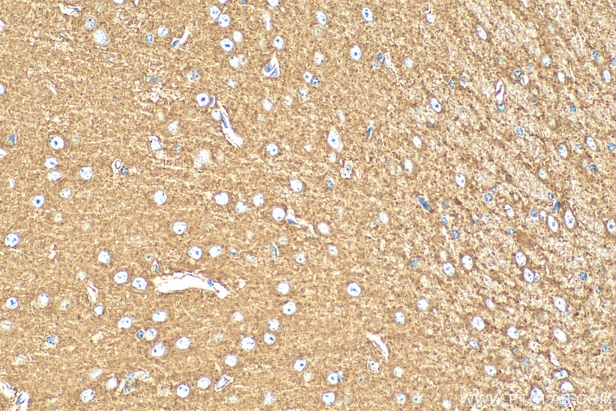 Immunohistochemistry (IHC) staining of mouse brain tissue using Hexokinase 1 Polyclonal antibody (19662-1-AP)