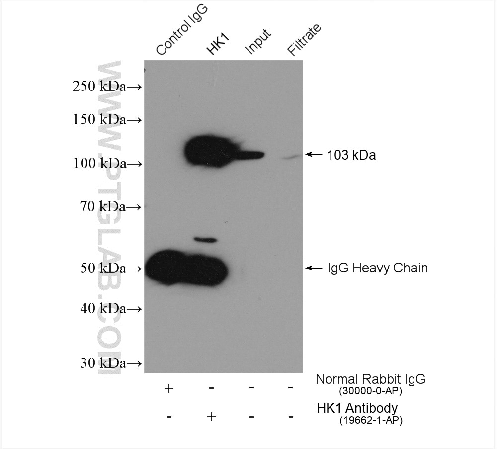 Immunoprecipitation (IP) experiment of HeLa cells using Hexokinase 1 Polyclonal antibody (19662-1-AP)