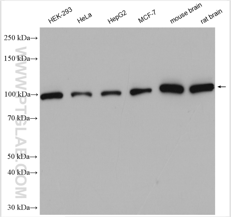 Western Blot (WB) analysis of various lysates using Hexokinase 1 Polyclonal antibody (19662-1-AP)