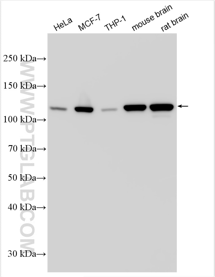 Western Blot (WB) analysis of various lysates using human Hexokinase 1 Polyclonal antibody (19662-1-AP)