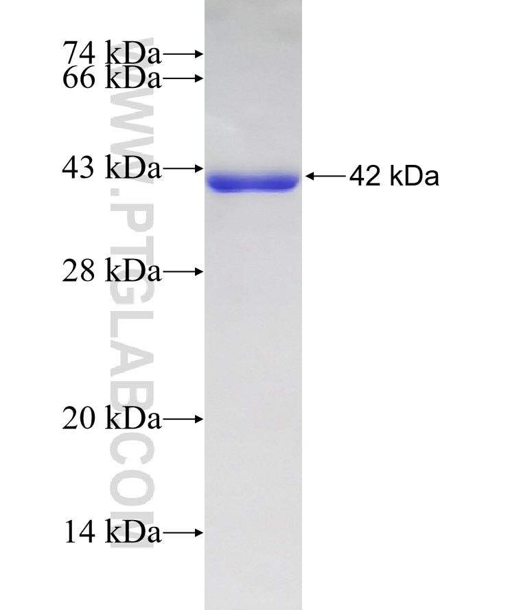 HK1 fusion protein Ag8015 SDS-PAGE