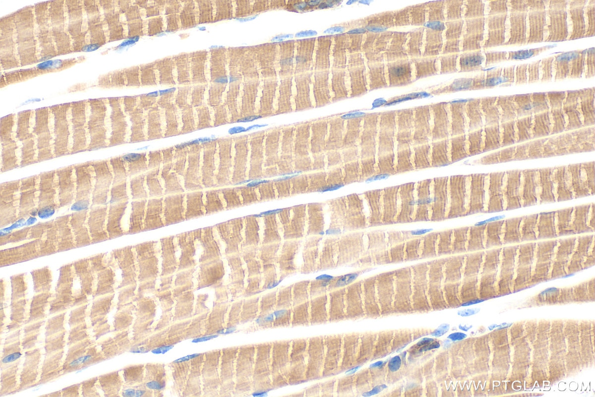 Immunohistochemistry (IHC) staining of mouse skeletal muscle tissue using Hexokinase 2 Polyclonal antibody (22029-1-AP)