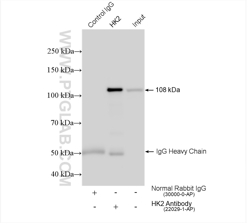 Immunoprecipitation (IP) experiment of HeLa cells using Hexokinase 2 Polyclonal antibody (22029-1-AP)