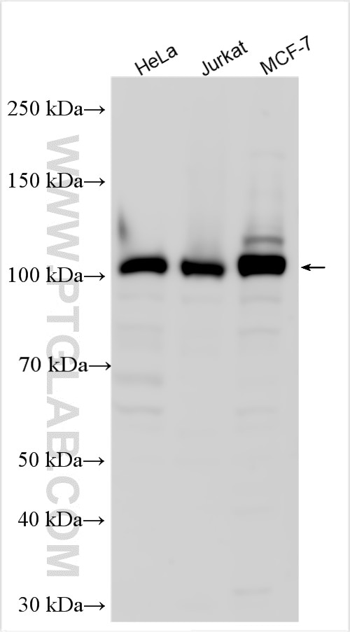 Western Blot (WB) analysis of various lysates using Hexokinase 2 Polyclonal antibody (22029-1-AP)