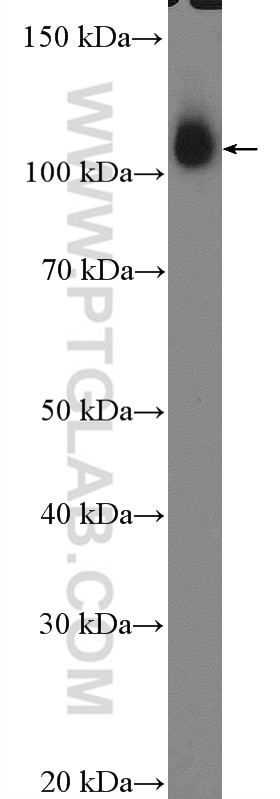 WB analysis of mouse skeletal muscle using 22029-1-AP