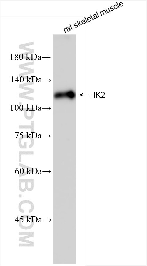 Western Blot (WB) analysis of rat skeletal muscle tissue using Hexokinase 2 Polyclonal antibody (22029-1-AP)