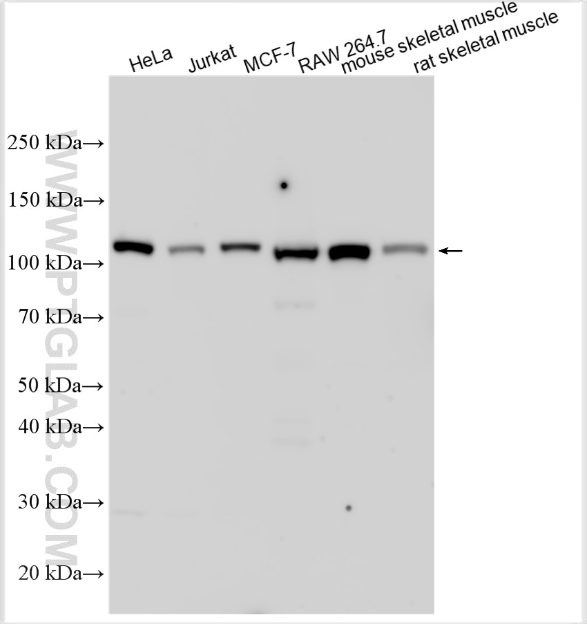 Western Blot (WB) analysis of various lysates using Hexokinase 2 Polyclonal antibody (22029-1-AP)