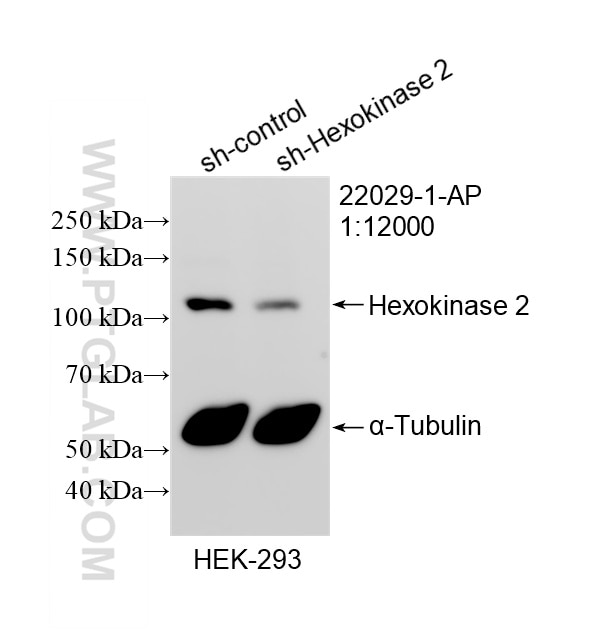 Western Blot (WB) analysis of HEK-293 cells using Hexokinase 2 Polyclonal antibody (22029-1-AP)