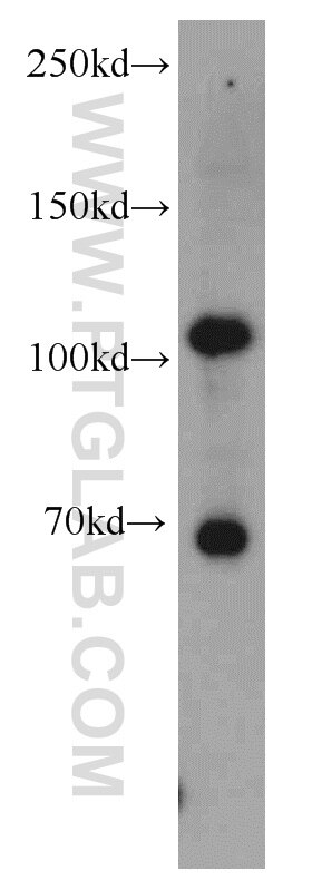 Hexokinase 2 Polyclonal antibody