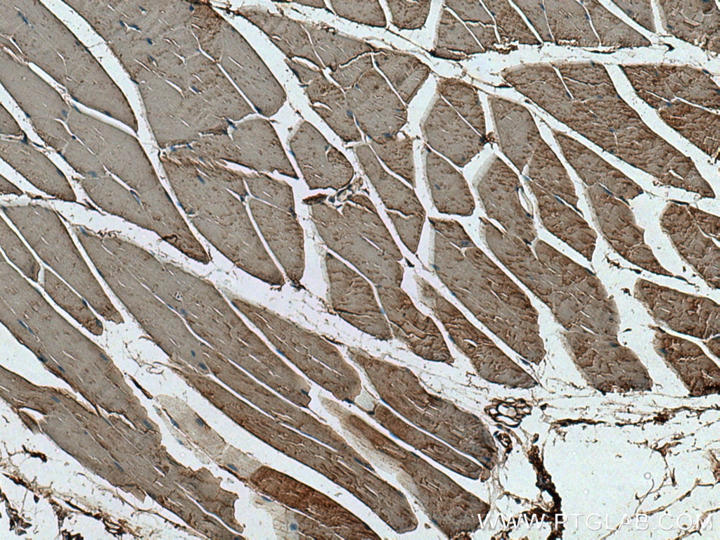 Immunohistochemistry (IHC) staining of mouse skeletal muscle tissue using Hexokinase 2 Monoclonal antibody (66974-1-Ig)
