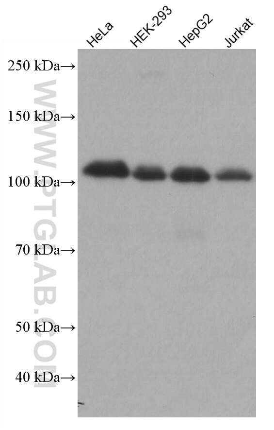 Hexokinase 2