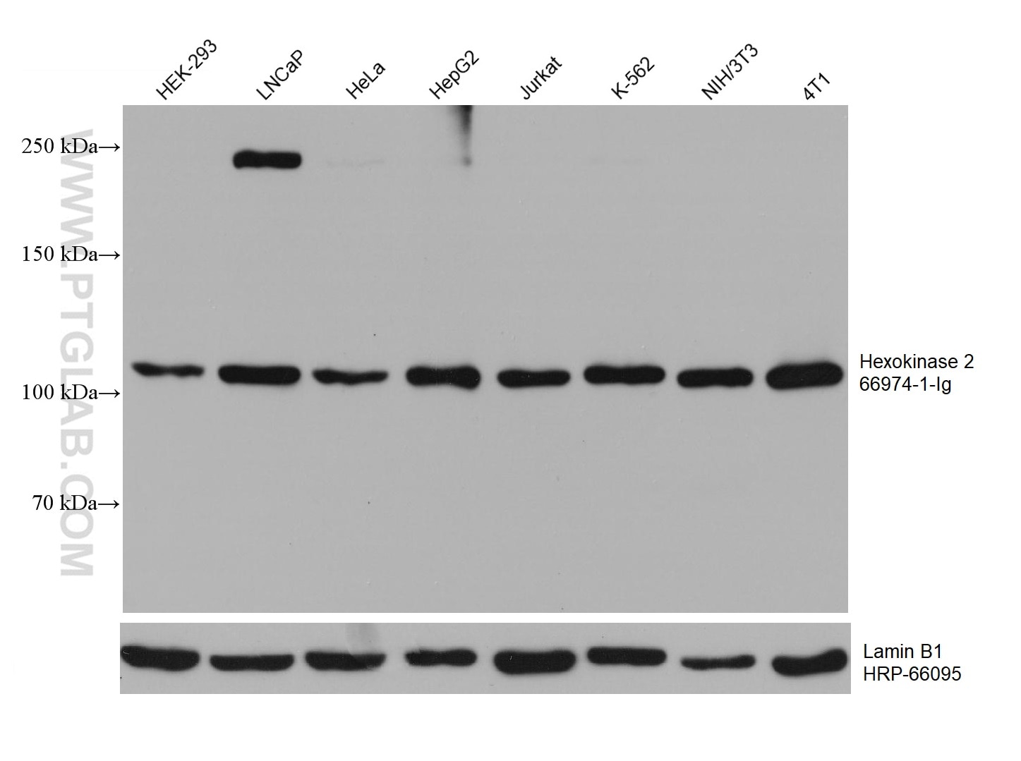 Western Blot (WB) analysis of various lysates using Hexokinase 2 Monoclonal antibody (66974-1-Ig)