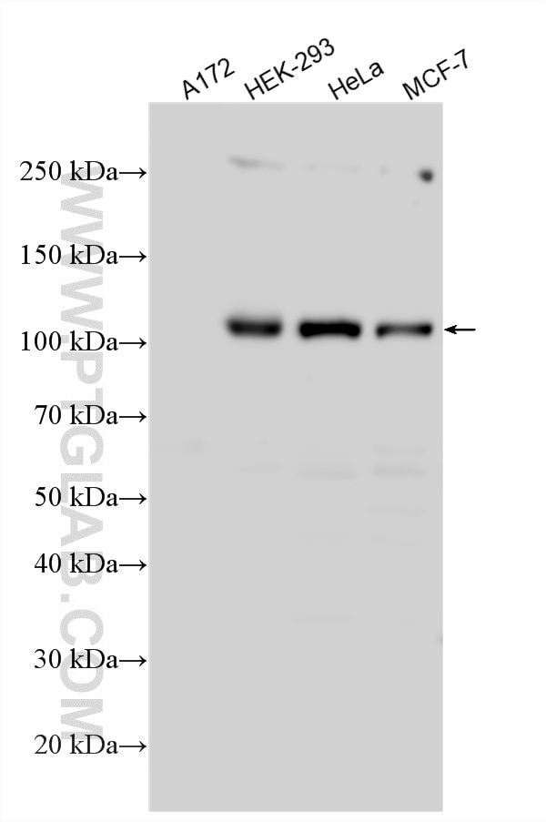 Various lysates were subjected to SDS PAGE followed by western blot with 66974-1-Ig (Hexokinase 2 antibody) at dilution of 1:10000 incubated at room temperature for 1.5 hours. A172 cells as a negative control. Western Blot (WB) analysis of various lysates using Hexokinase 2 Monoclonal antibody (66974-1-Ig)