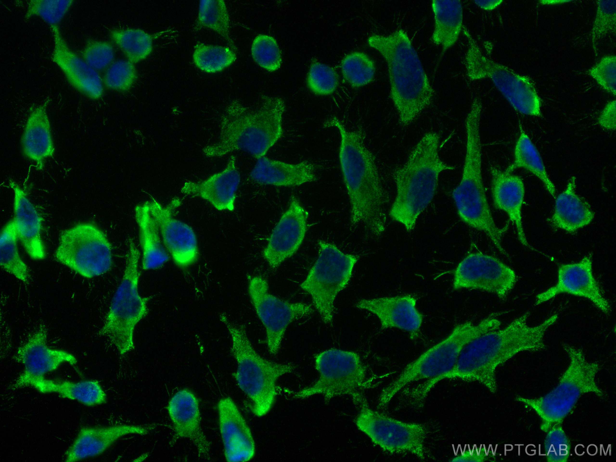 Immunofluorescence (IF) / fluorescent staining of HeLa cells using HK3 Monoclonal antibody (67803-1-Ig)