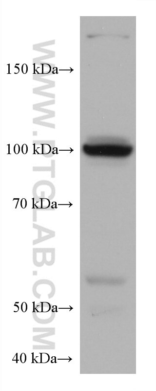Western Blot (WB) analysis of Raji cells using HK3 Monoclonal antibody (67803-1-Ig)
