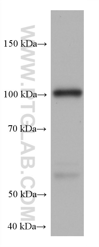 Western Blot (WB) analysis of Ramos cells using HK3 Monoclonal antibody (67803-1-Ig)