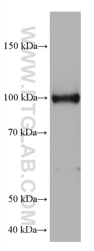 Western Blot (WB) analysis of rat spleen tissue using HK3 Monoclonal antibody (67803-1-Ig)
