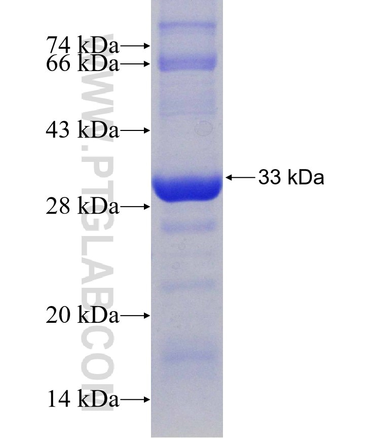 HK3 fusion protein Ag30798 SDS-PAGE