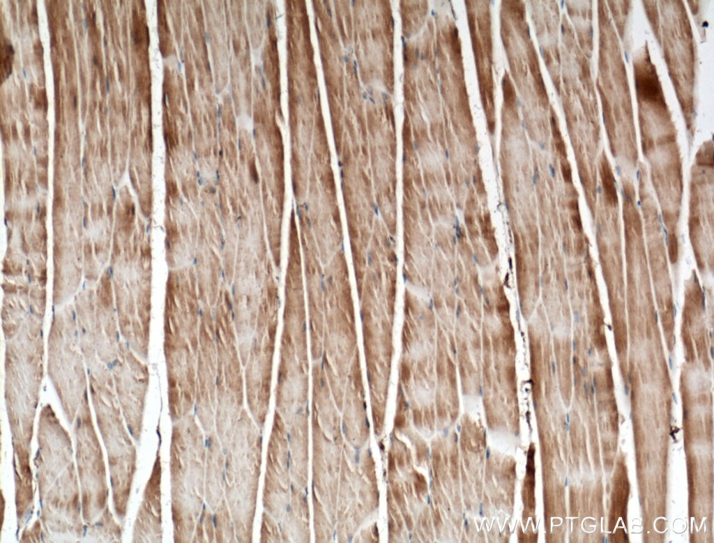 Immunohistochemistry (IHC) staining of mouse skeletal muscle tissue using HKDC1 Polyclonal antibody (25874-1-AP)