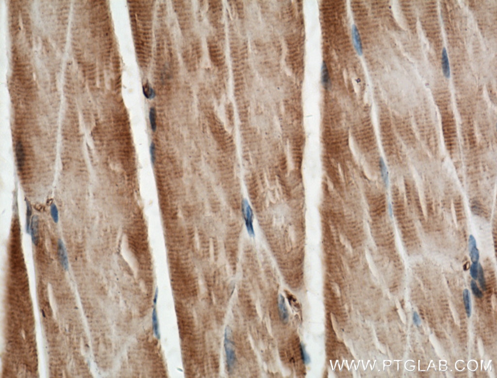 Immunohistochemistry (IHC) staining of mouse skeletal muscle tissue using HKDC1 Polyclonal antibody (25874-1-AP)