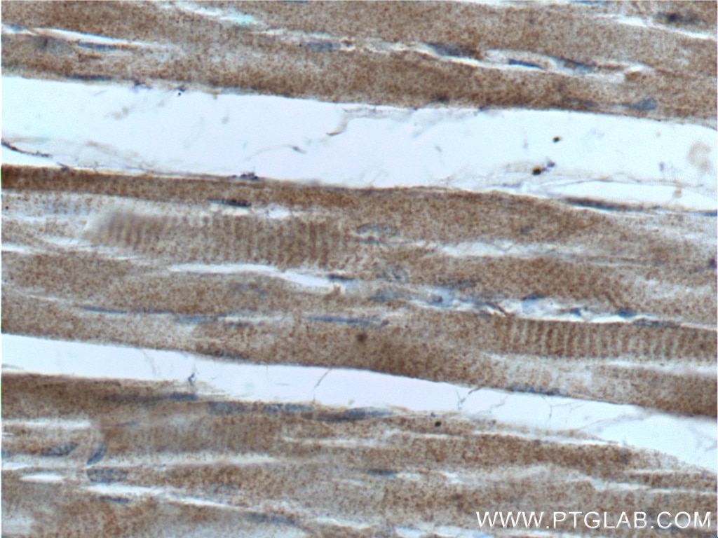 Immunohistochemistry (IHC) staining of human skeletal muscle tissue using HKDC1 Polyclonal antibody (25874-1-AP)